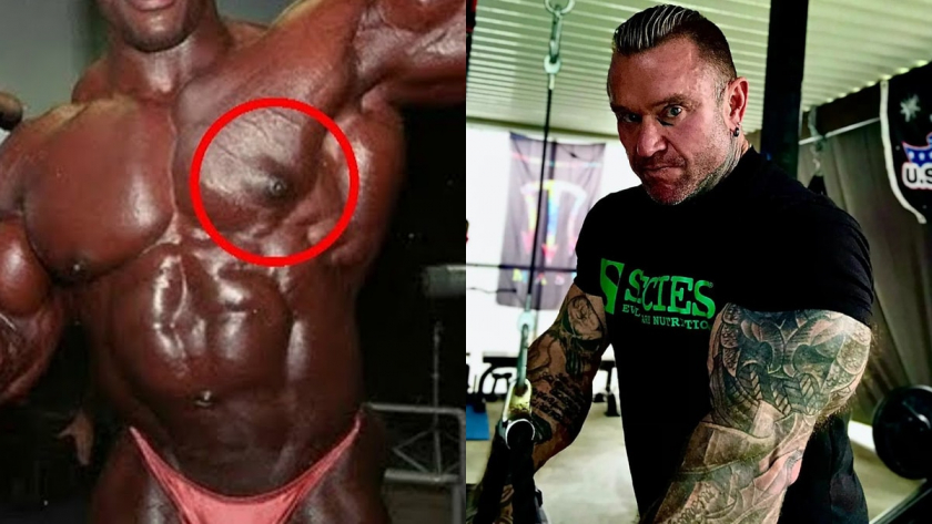 Лед против гинекомастии - Ли Прист дает соревновательные советы