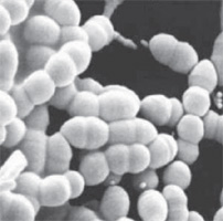 Молочная кислота. Друг или все-таки враг?