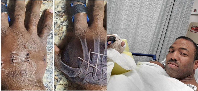 Седрику МакМиллану сделали операцию